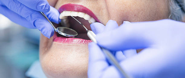 Best Emergency Treatment for Dental Infections or Abscesses in Cave Creek, AZ